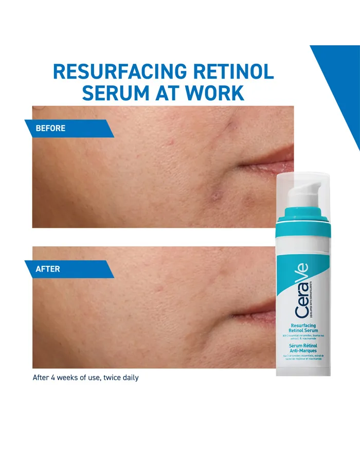 Resurfacing Retinol Serum with Ceramides & Niacinamide